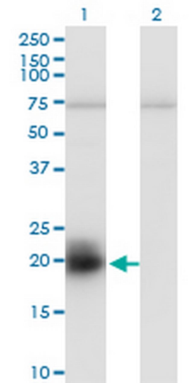 HAND2 Antibody in Western Blot (WB)