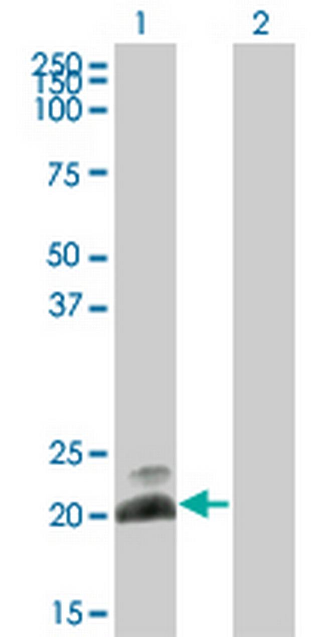 HAND2 Antibody in Western Blot (WB)