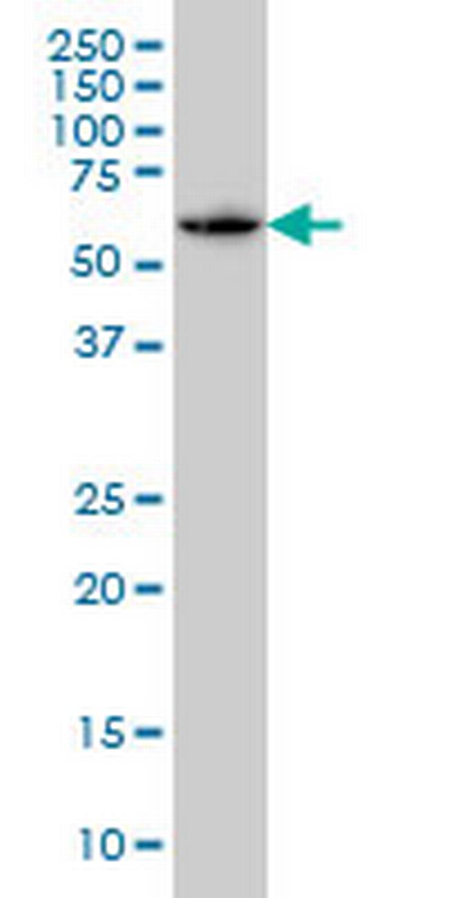 SH3BP5 Antibody in Western Blot (WB)