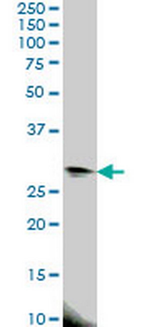 EIF4E2 Antibody in Western Blot (WB)