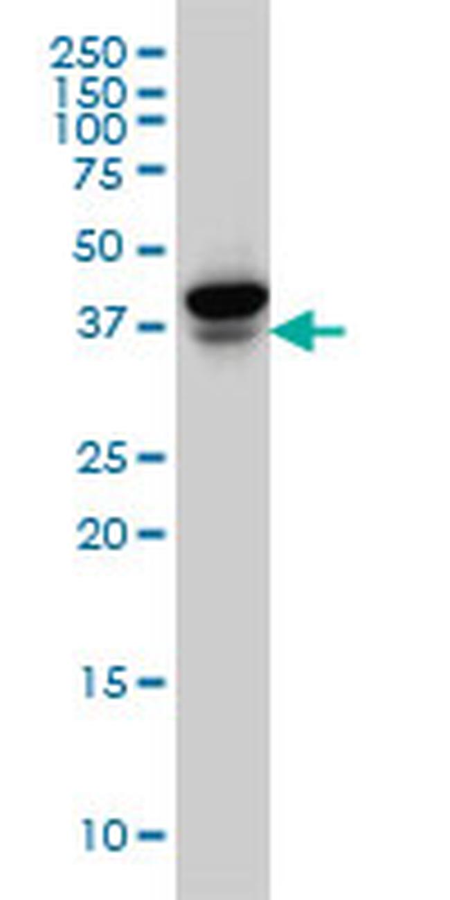 EIF4E2 Antibody in Western Blot (WB)