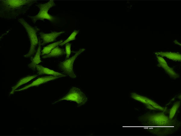 C1ORF38 Antibody in Immunocytochemistry (ICC/IF)