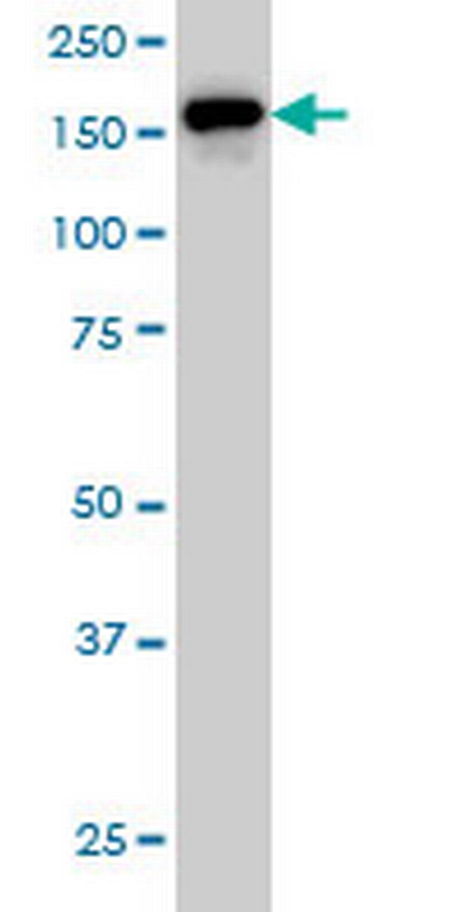 ROCK2 Antibody in Western Blot (WB)