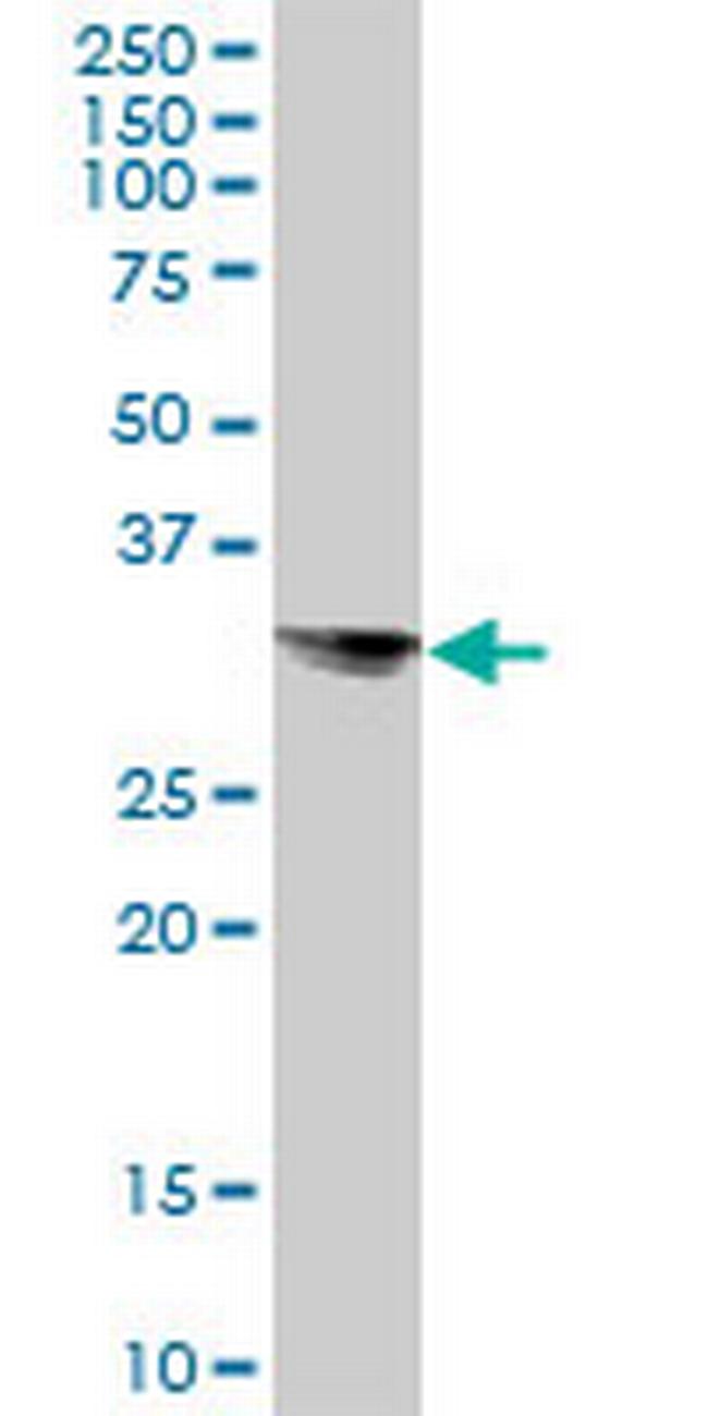 STX8 Antibody in Western Blot (WB)