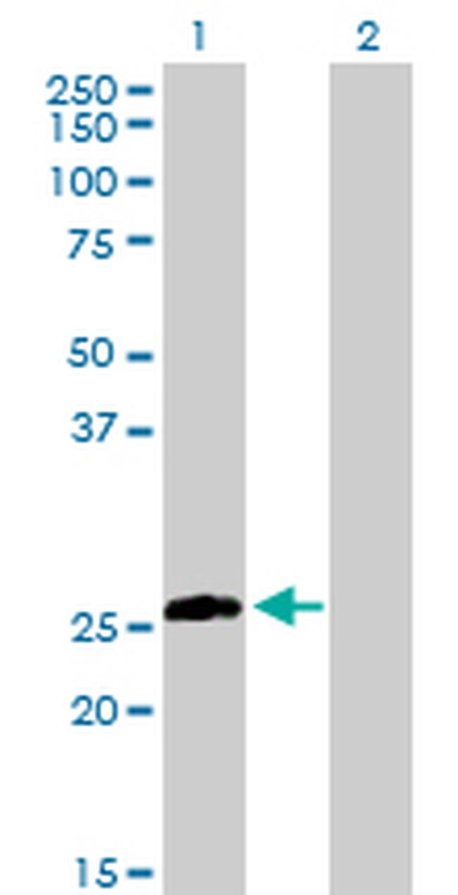 STX8 Antibody in Western Blot (WB)