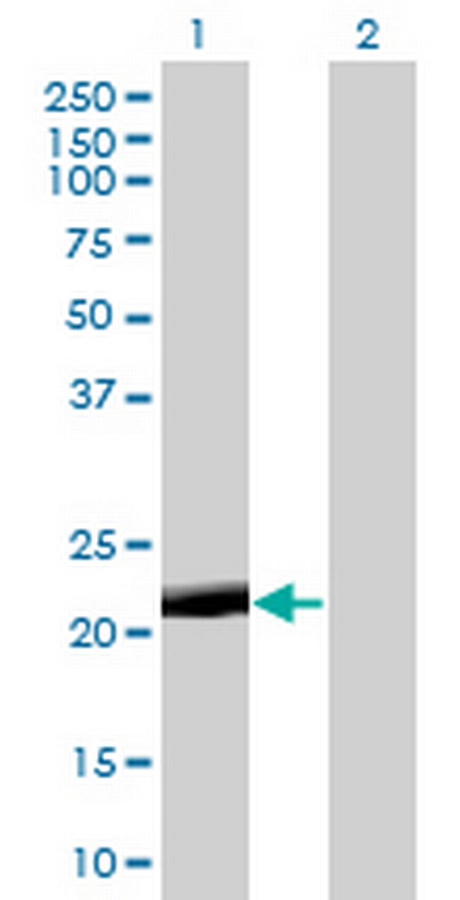 PAGE4 Antibody in Western Blot (WB)