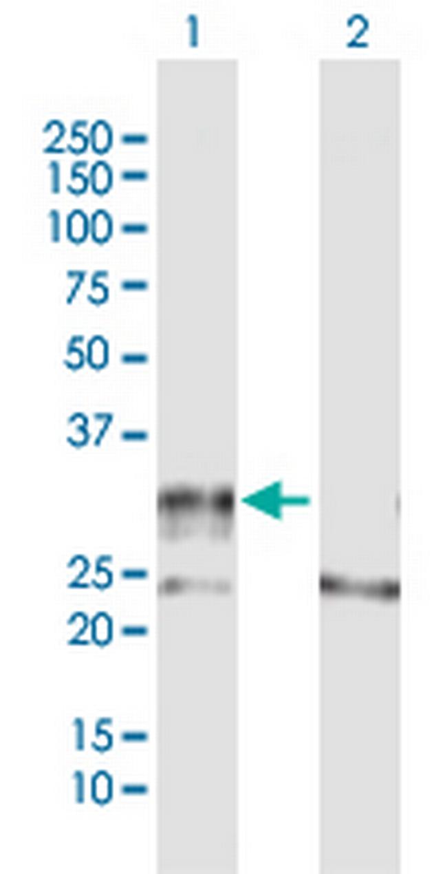 ADAMTS4 Antibody in Western Blot (WB)