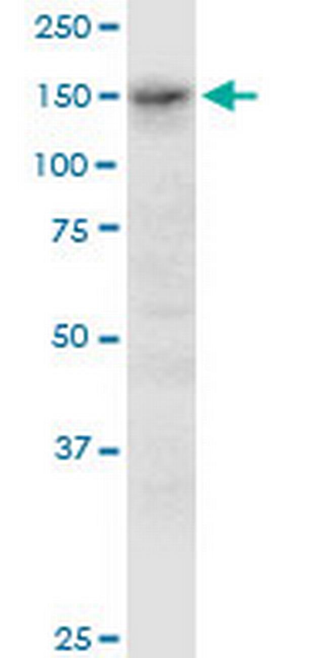 ADAMTS3 Antibody in Western Blot (WB)