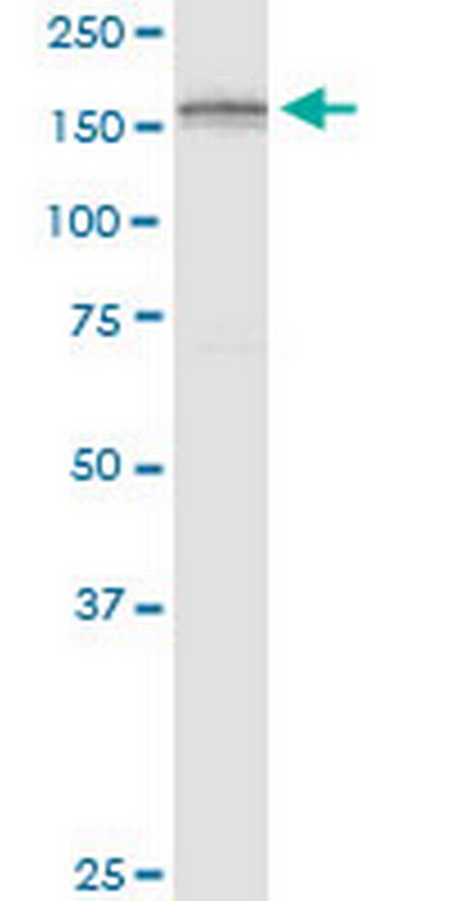 ADAMTS3 Antibody in Western Blot (WB)