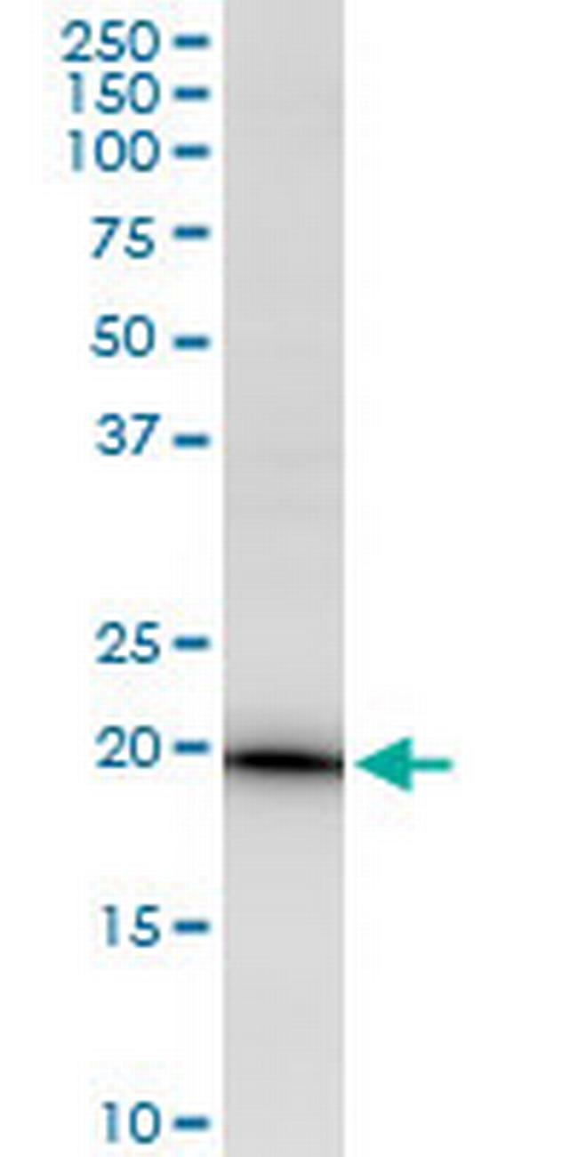 EEF1E1 Antibody in Western Blot (WB)