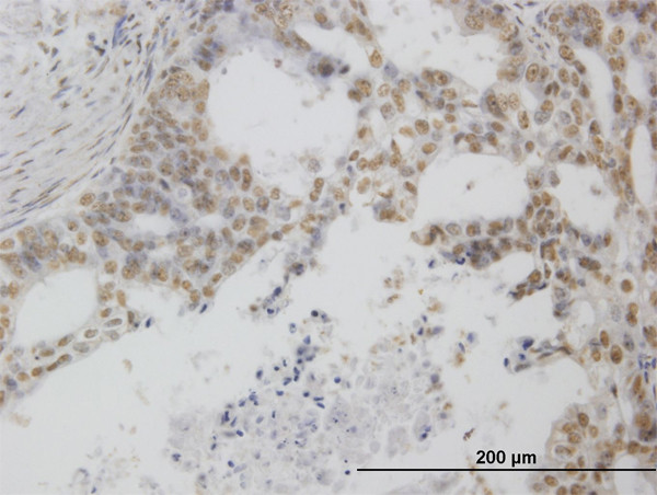 POLR1C Antibody in Immunohistochemistry (Paraffin) (IHC (P))