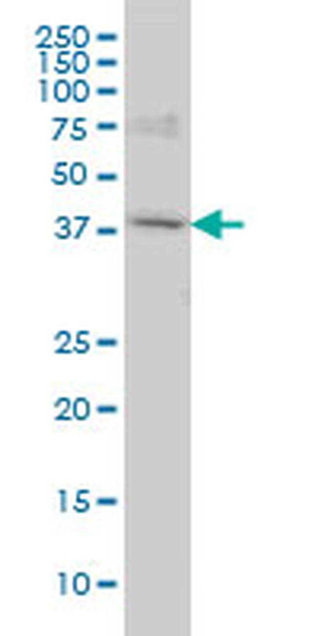 POLR1C Antibody in Western Blot (WB)