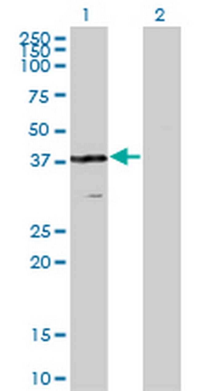 VPS26A Antibody in Western Blot (WB)