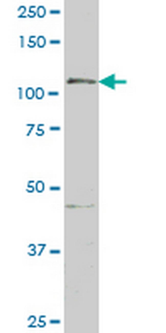 GTF2IRD1 Antibody in Western Blot (WB)