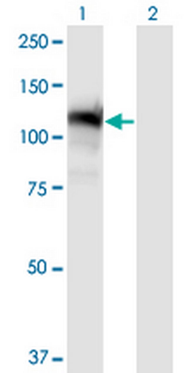 GTF2IRD1 Antibody in Western Blot (WB)