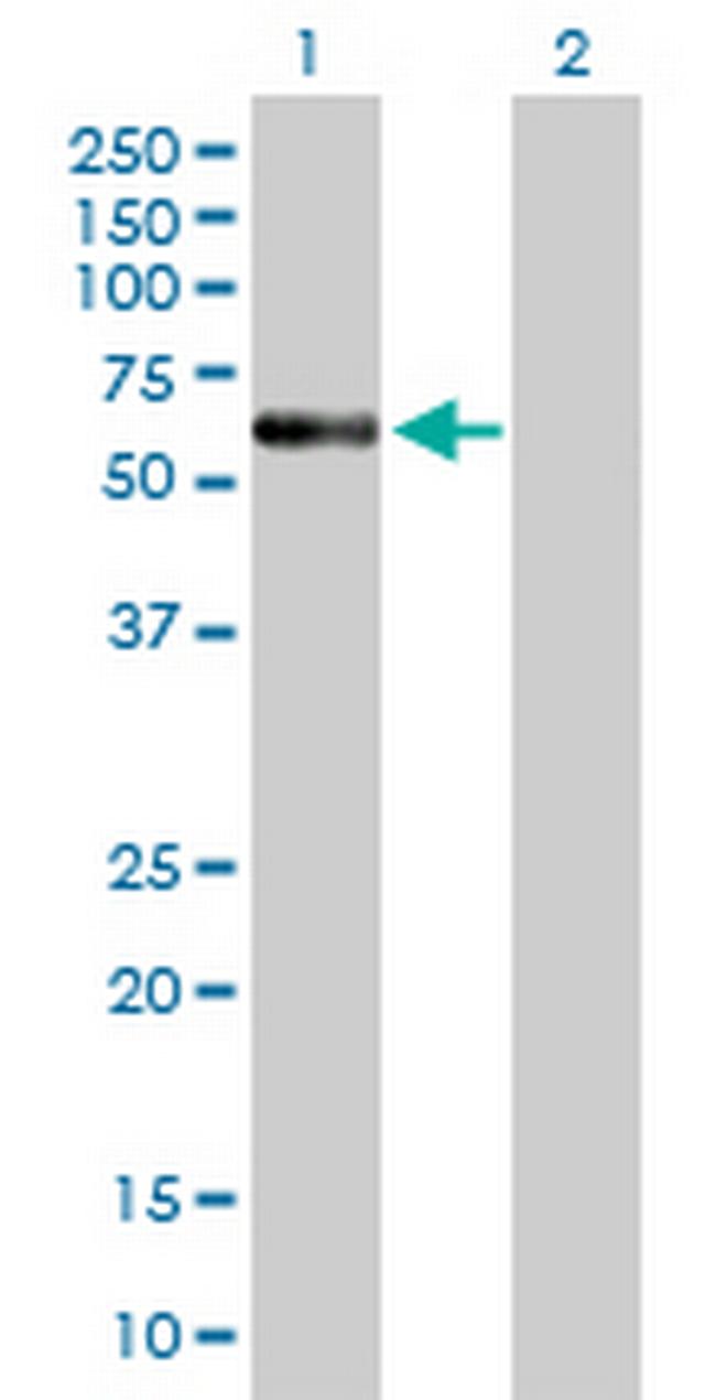 ENTPD4 Antibody in Western Blot (WB)