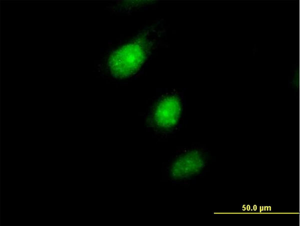 MAD2L1BP Antibody in Immunocytochemistry (ICC/IF)