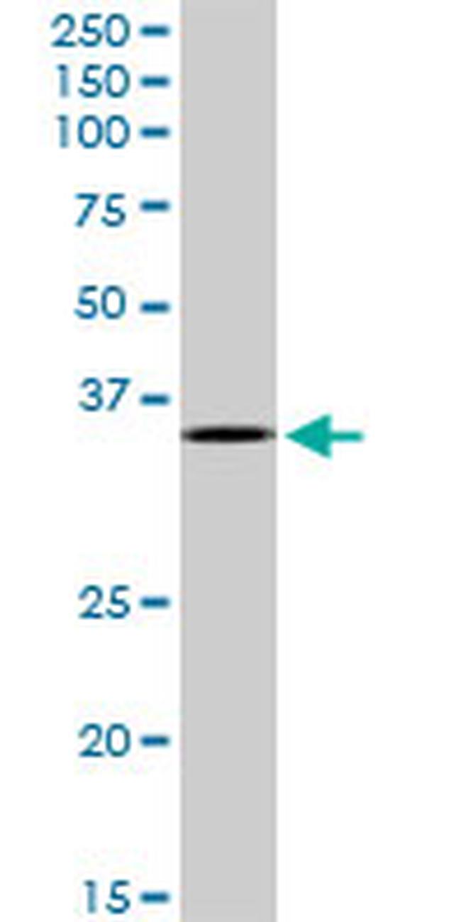 MAD2L1BP Antibody in Western Blot (WB)