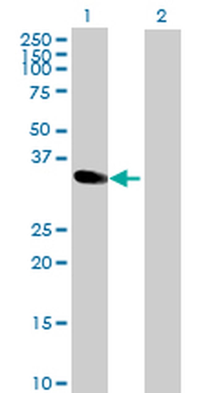 MAD2L1BP Antibody in Western Blot (WB)