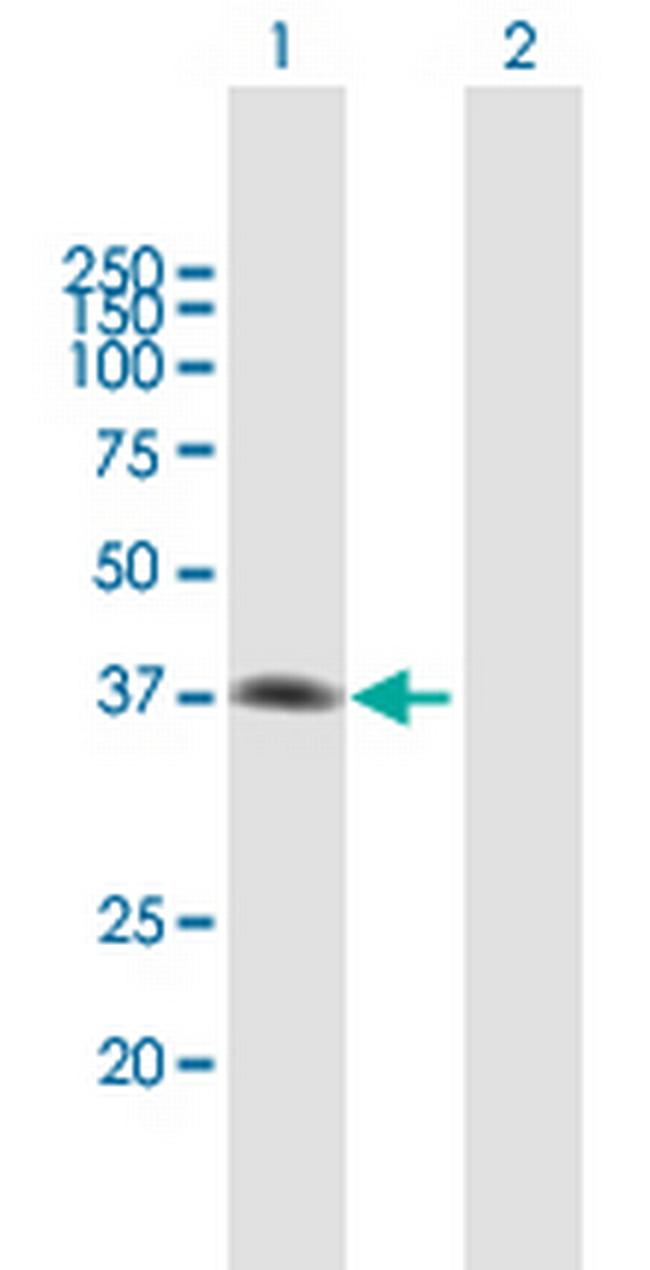 MAD2L1BP Antibody in Western Blot (WB)