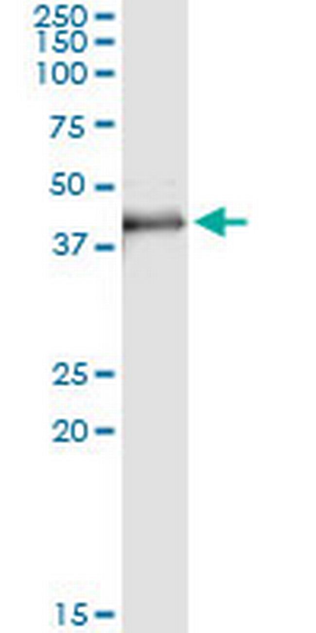 MAD2L1BP Antibody in Immunoprecipitation (IP)