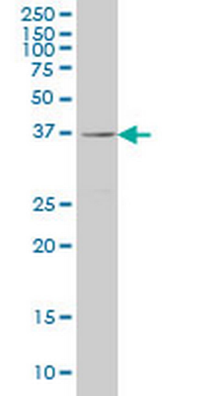 RAB36 Antibody in Western Blot (WB)