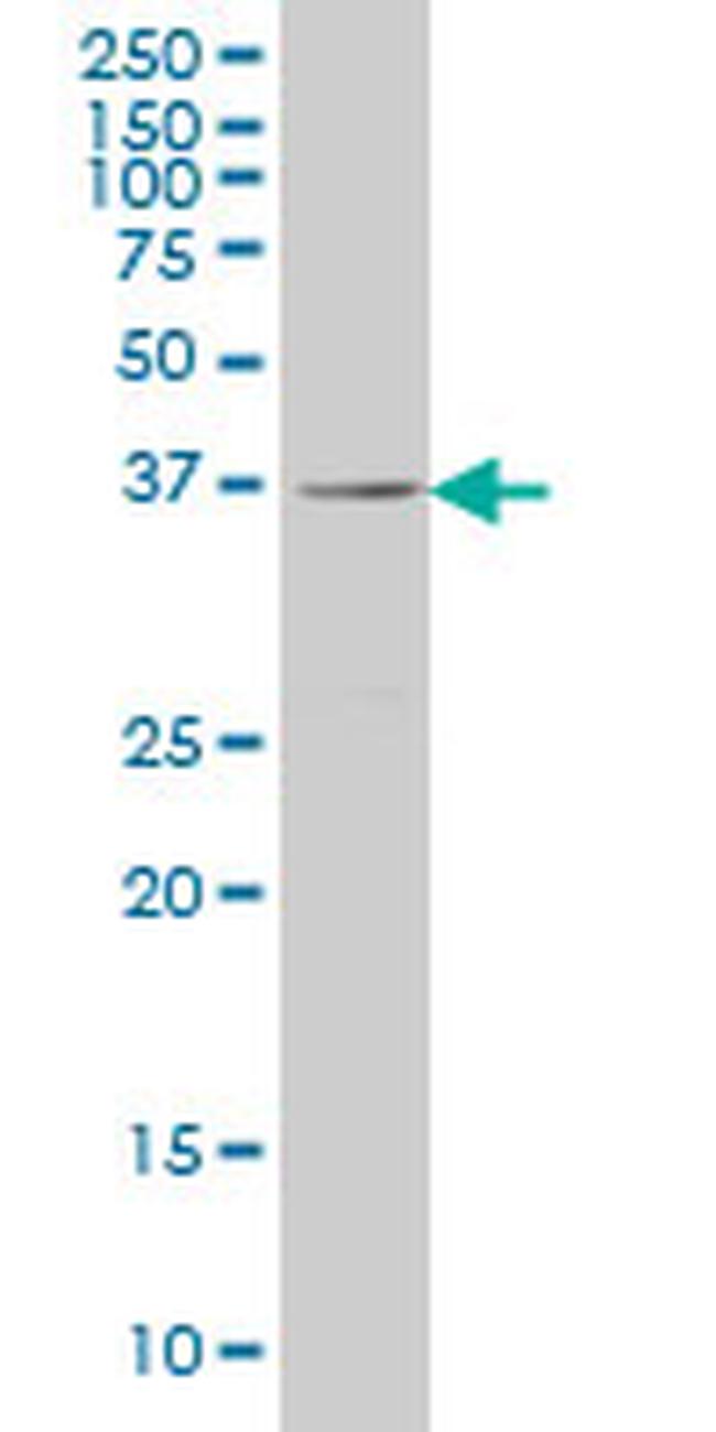 RAB36 Antibody in Western Blot (WB)
