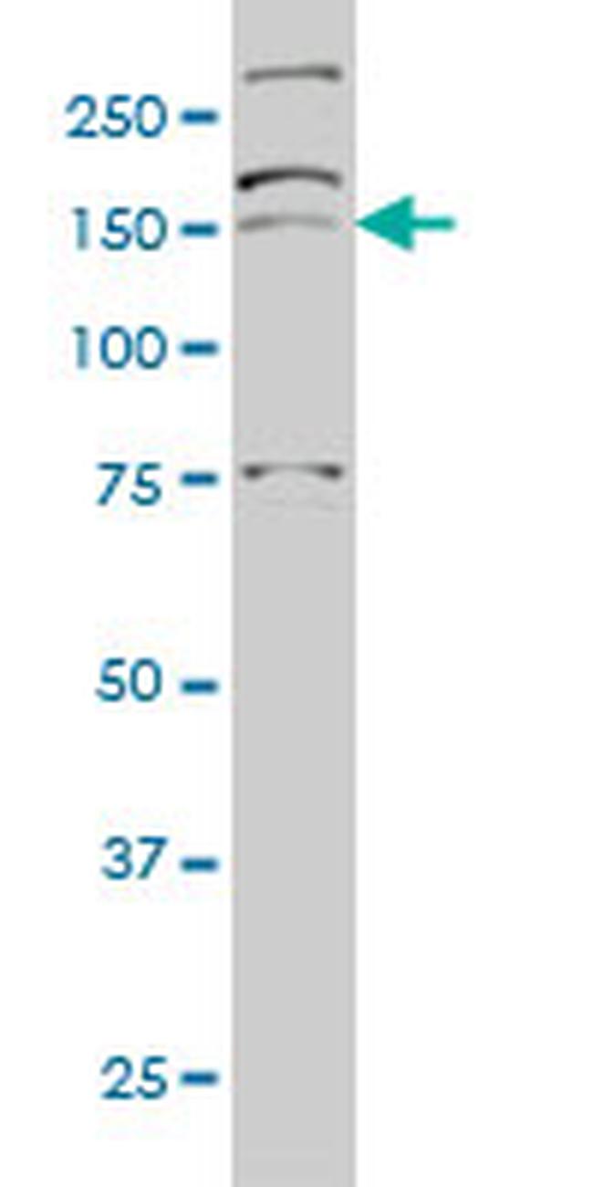 AATK Antibody in Western Blot (WB)