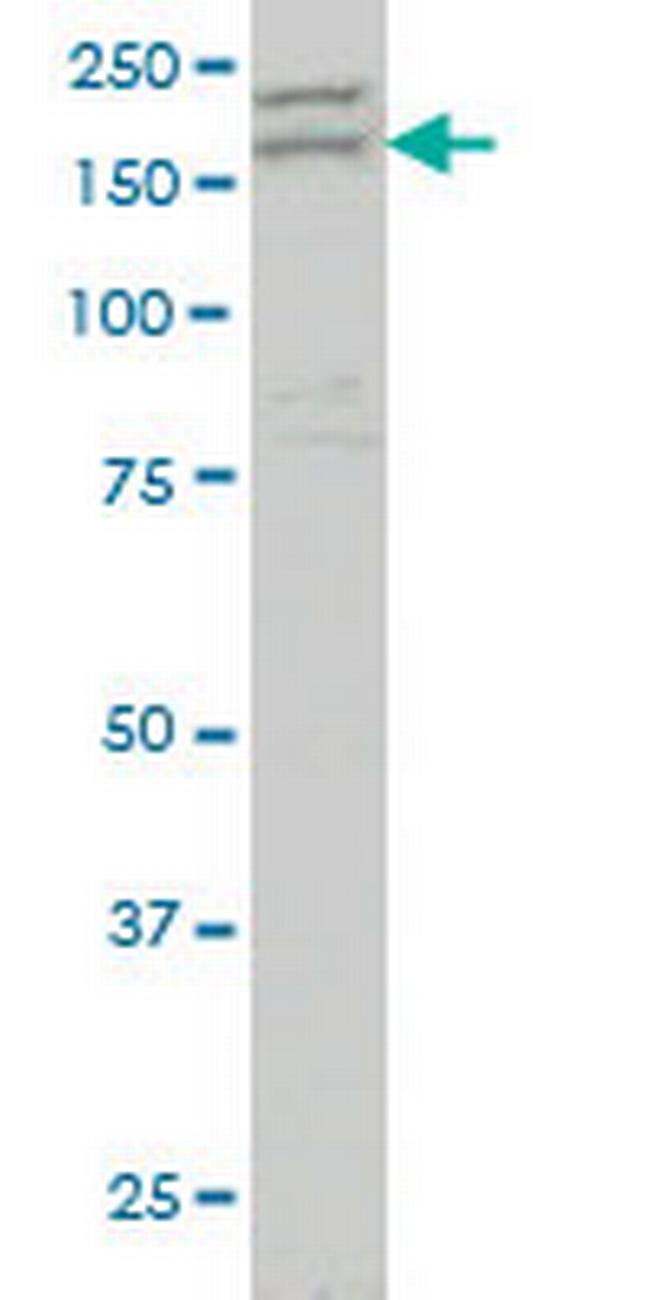 AATK Antibody in Western Blot (WB)