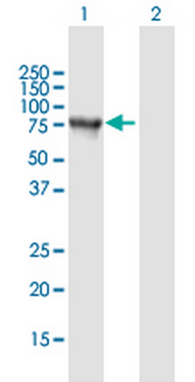 SNCAIP Antibody in Western Blot (WB)