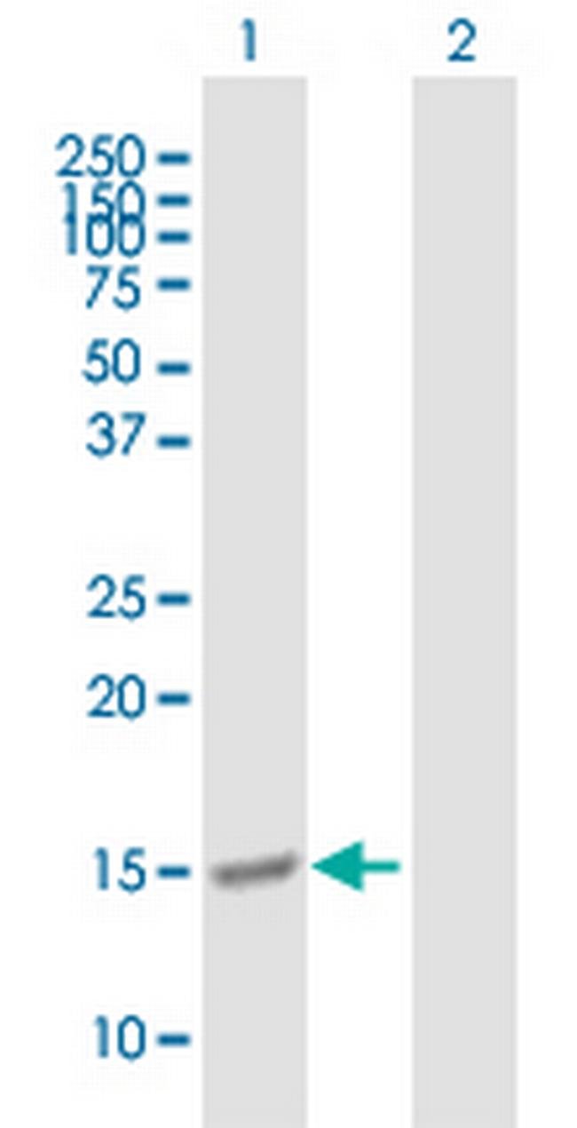 G1P2 Antibody in Western Blot (WB)