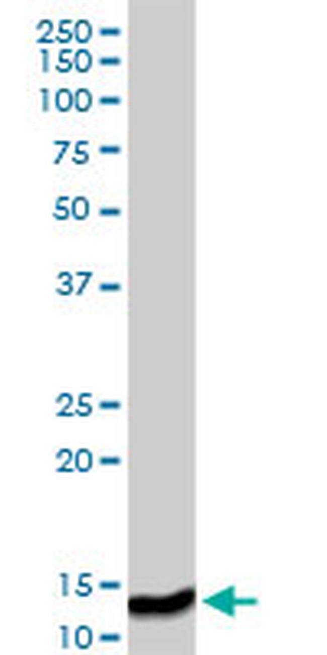 ISG15 Antibody in Western Blot (WB)