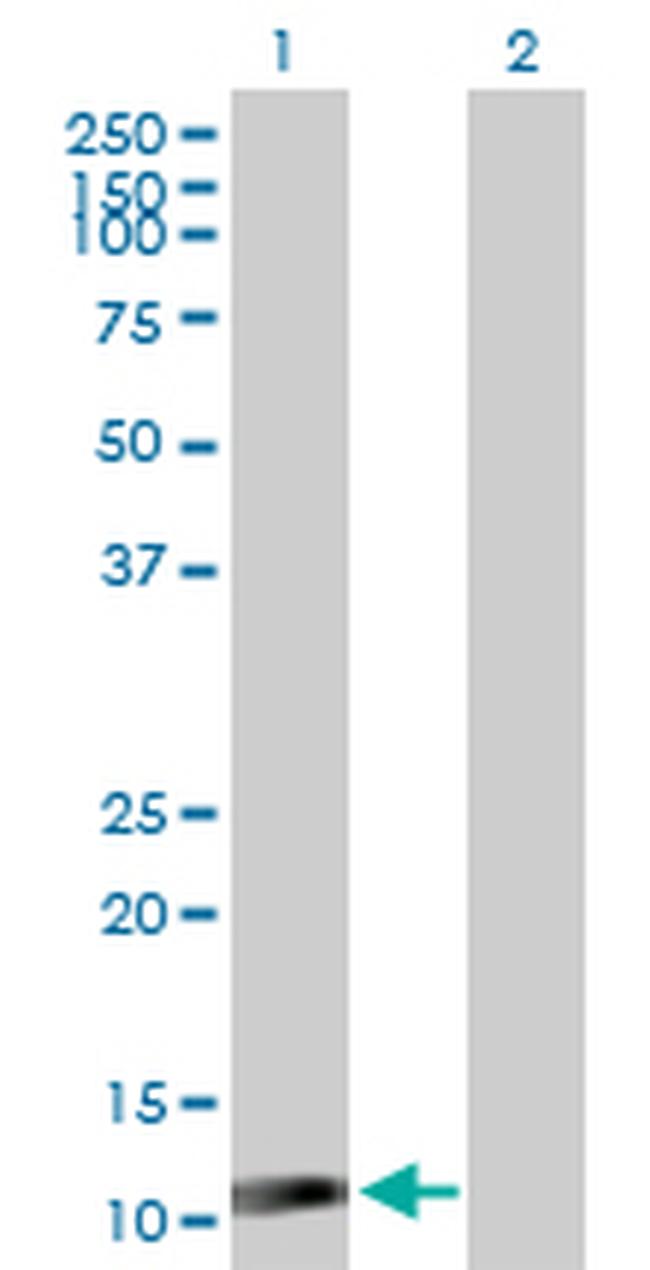 ISG15 Antibody in Western Blot (WB)