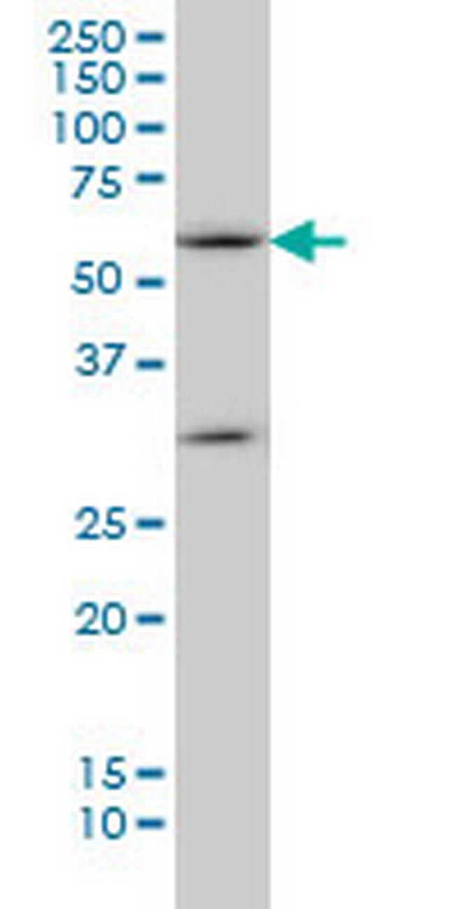 SOCS5 Antibody in Western Blot (WB)