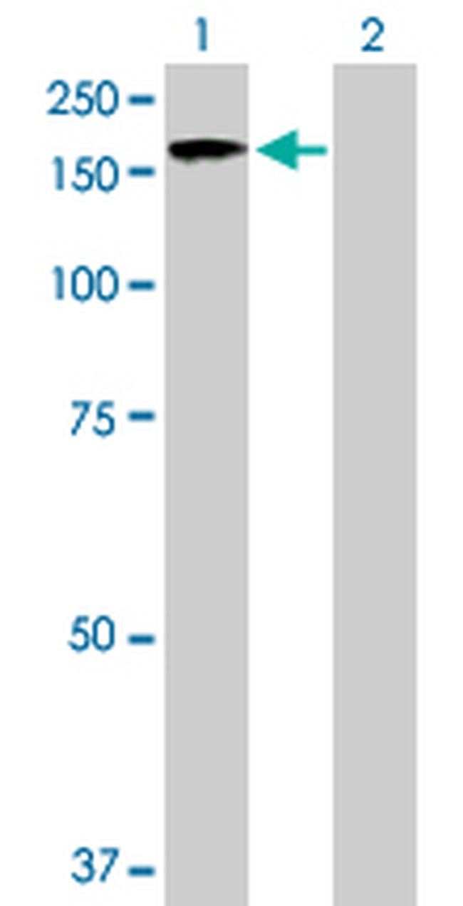 RIMS2 Antibody in Western Blot (WB)