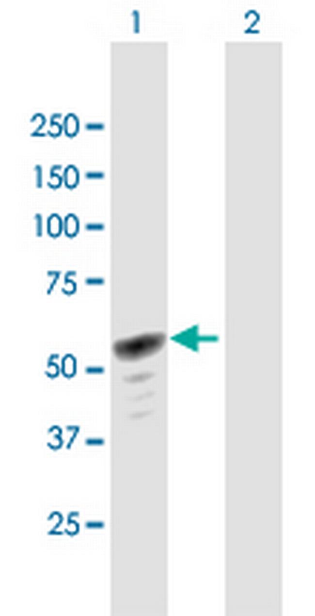 HERPUD1 Antibody in Western Blot (WB)