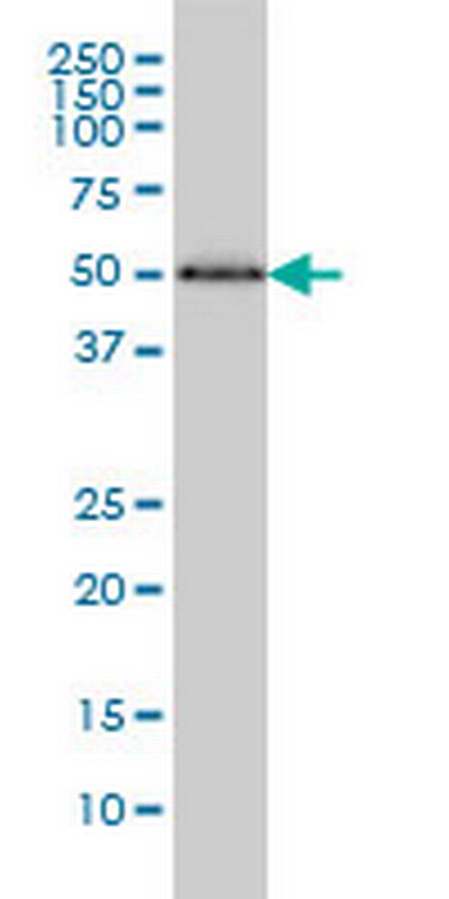 HERPUD1 Antibody in Western Blot (WB)