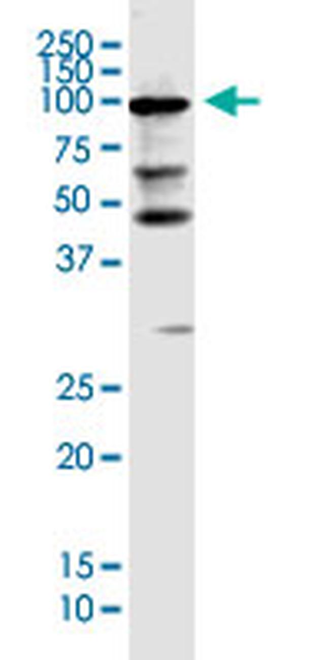 KIAA0226 Antibody in Western Blot (WB)