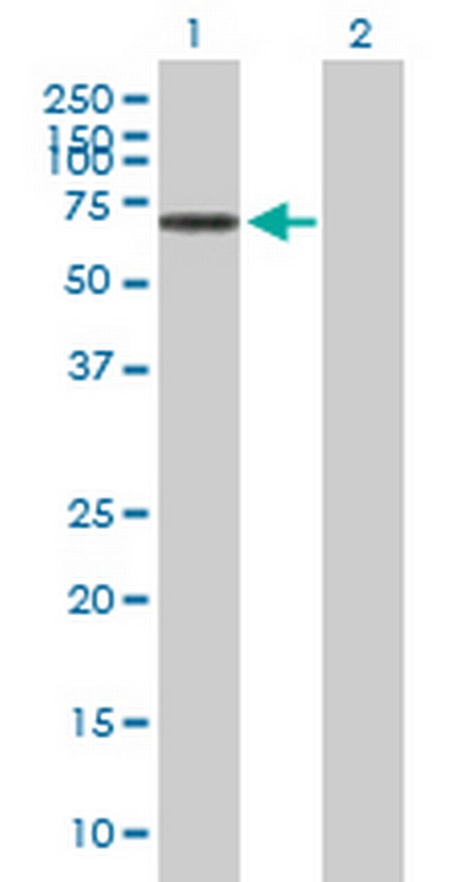 NOS1AP Antibody in Western Blot (WB)