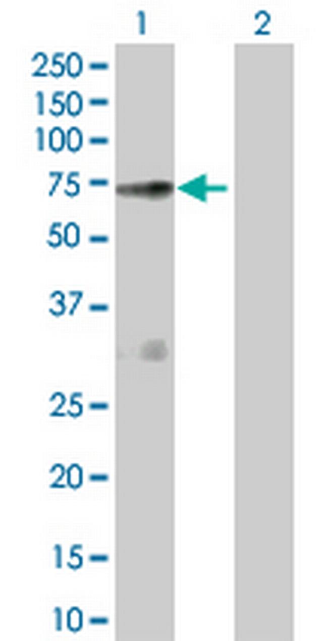 NOS1AP Antibody in Western Blot (WB)