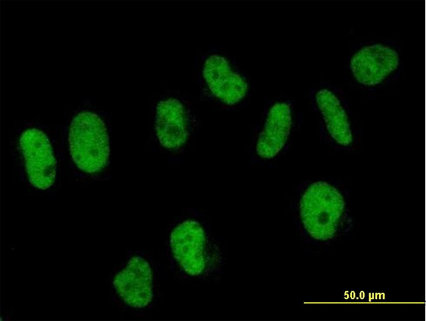 SART3 Antibody in Immunocytochemistry (ICC/IF)