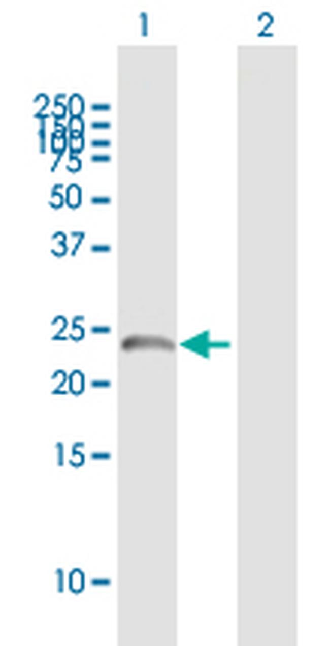 SART3 Antibody in Western Blot (WB)