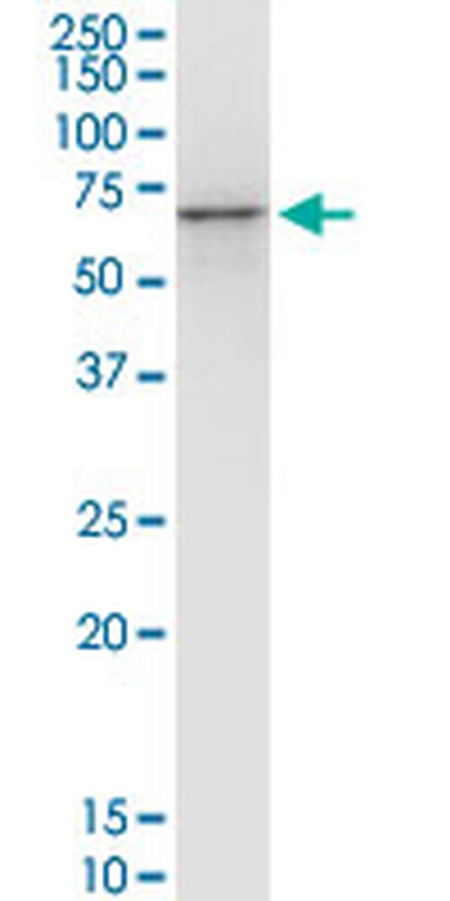 PHACTR2 Antibody in Western Blot (WB)