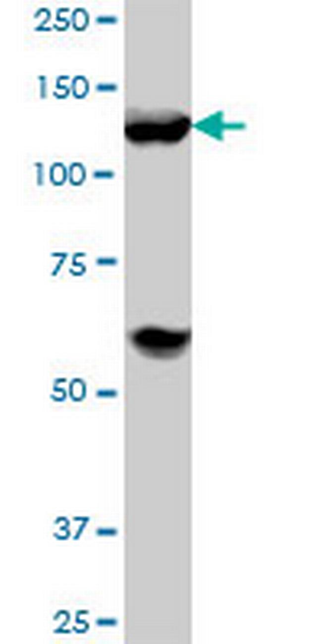 HDAC4 Antibody in Western Blot (WB)
