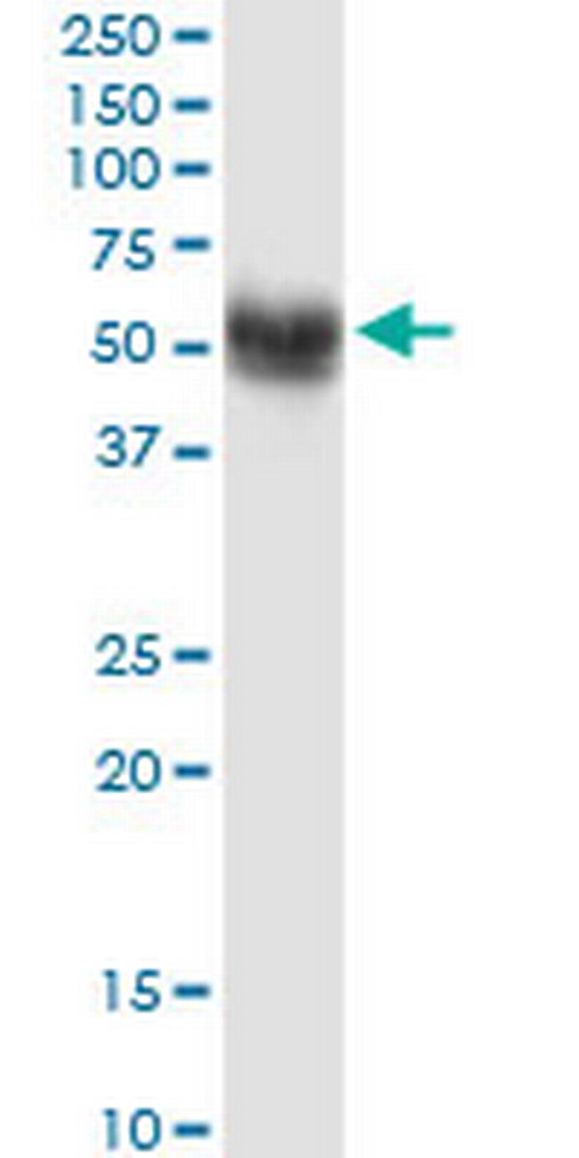 SNX17 Antibody in Western Blot (WB)