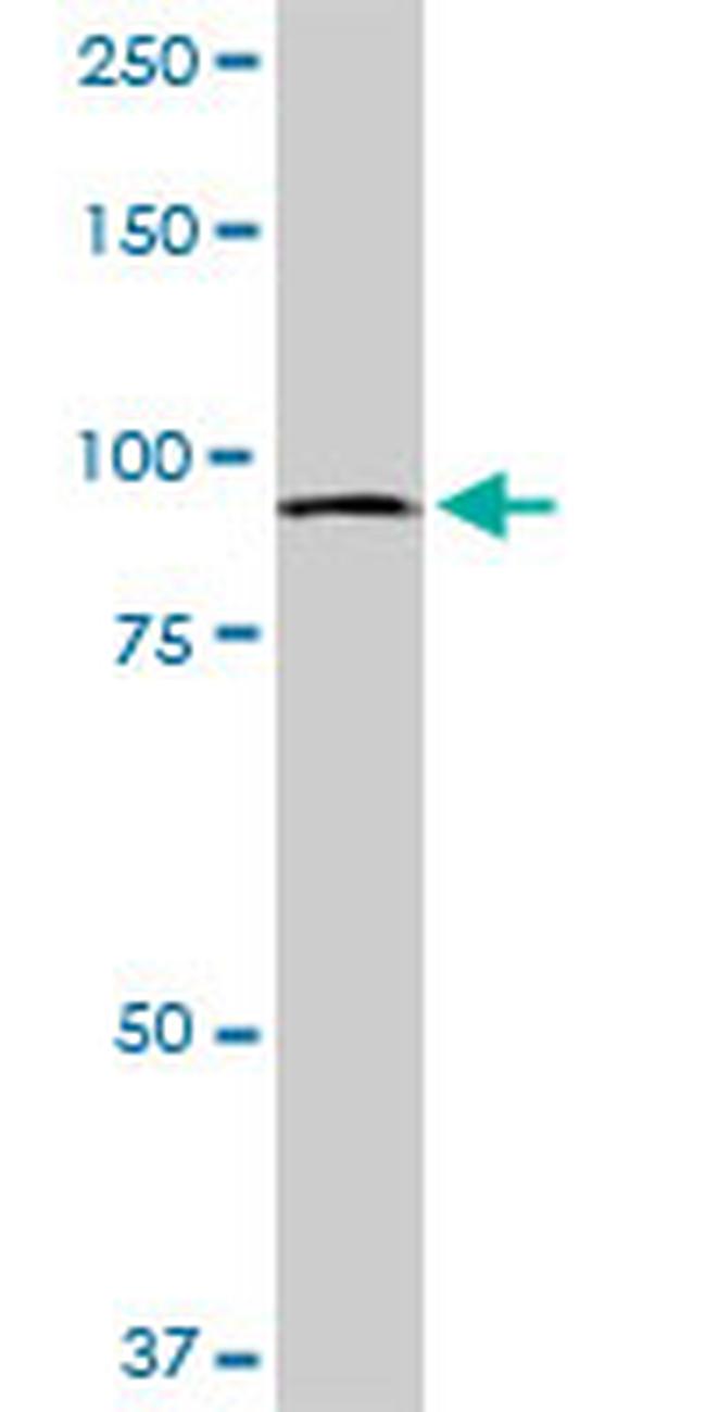 MTSS1 Antibody in Western Blot (WB)