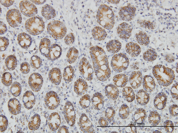 TOMM20 Antibody in Immunohistochemistry (Paraffin) (IHC (P))