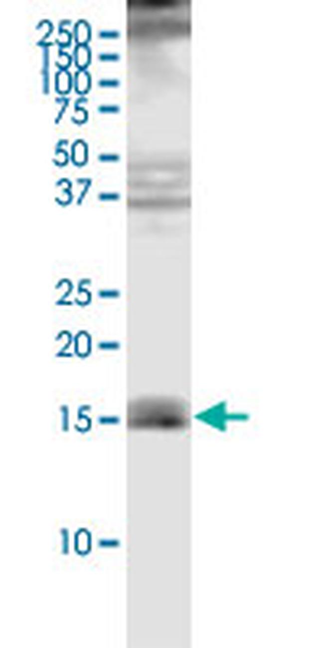 TOMM20 Antibody in Western Blot (WB)