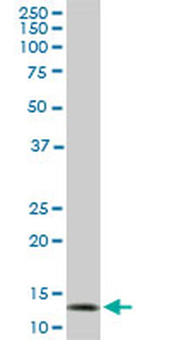 TOMM20 Antibody in Western Blot (WB)