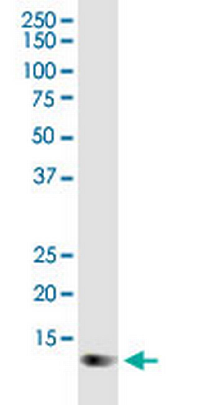 TOMM20 Antibody in Western Blot (WB)